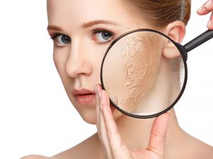 3 điều quan trọng hàng đầu trong cách chăm sóc da khô