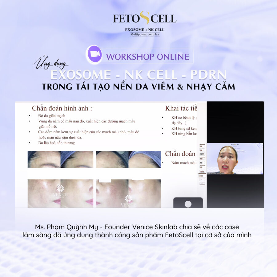 Ms Phạm Quỳnh My - Founder Venice Skinlab chia sẻ về các case lấm sàng sản phẩm FetoScell Regeneration