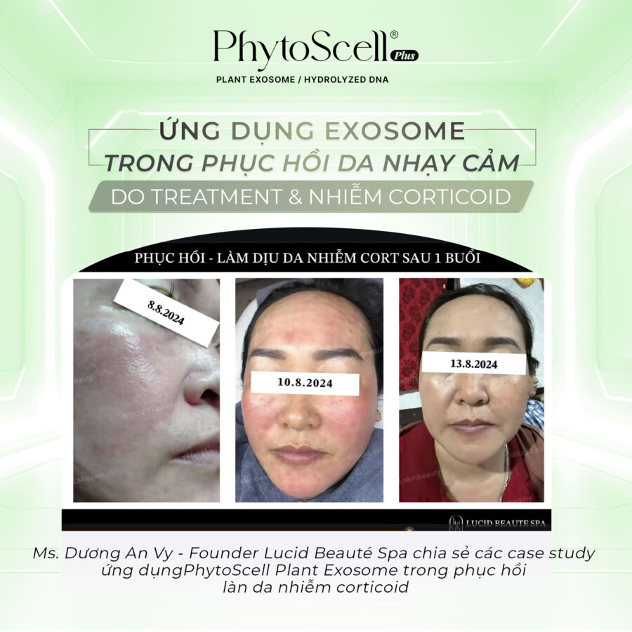 Ms. Dương An Vy chia sẻ về case lâm sàng ứng dụng PhytoScell trong phục hồi da nhạy cảm do nhiễm corticoid