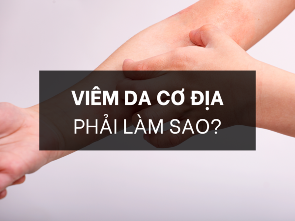 VIÊM DA CƠ ĐỊA PHẢI LÀM SAO?