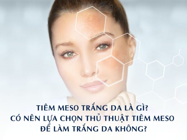 TIÊM MESO TRẮNG DA LÀ GÌ? CÓ NÊN LỰA CHỌN THỦ THUẬT TIÊM MESO ĐỂ LÀM TRẮNG DA KHÔNG?