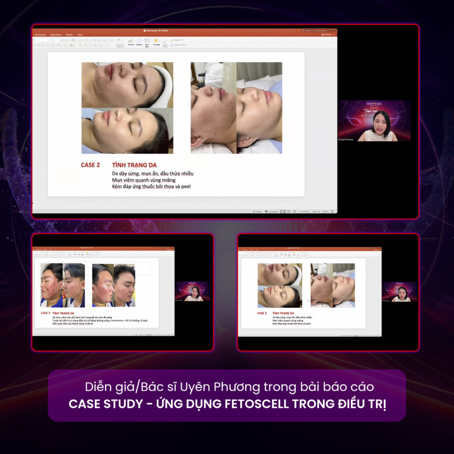 Diễn giả/Bác sĩ Uyên Phương với bài báo cáo "Case Study - Ứng dụng FetoScell trong điều trị"