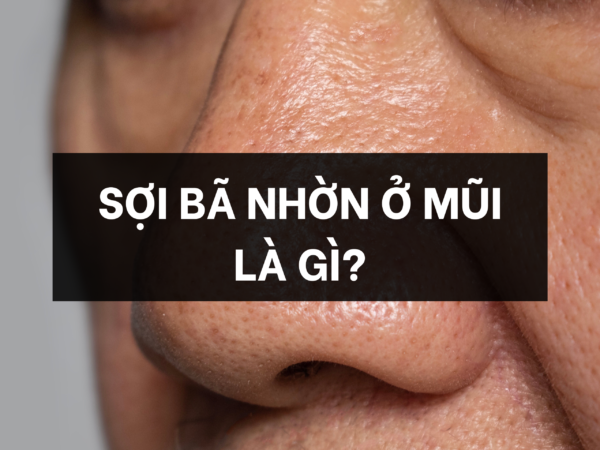 Sợi bã nhờn là gì?