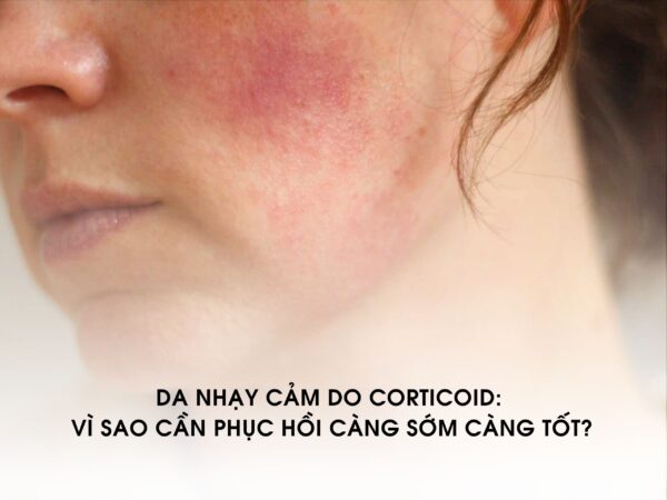 DA NHẠY CẢM DO CORTICOID: VÌ SAO CẦN PHỤC HỒI CÀNG SỚM CÀNG TỐT?