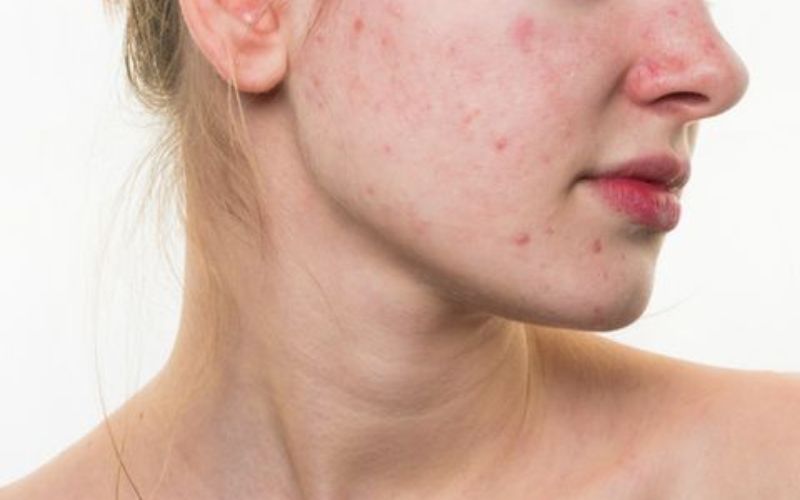 Vì sao skincare đơn giản lại hiệu quả?