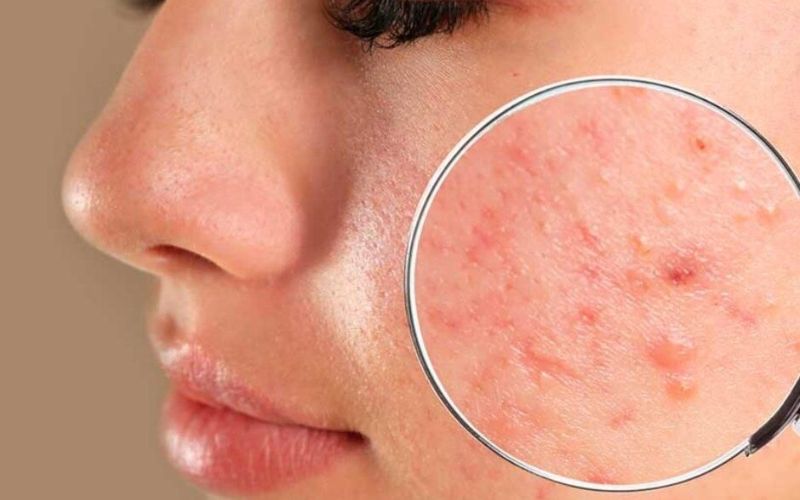 Môi trường nhiều tác nhân gây hại cũng có thể gây khô da