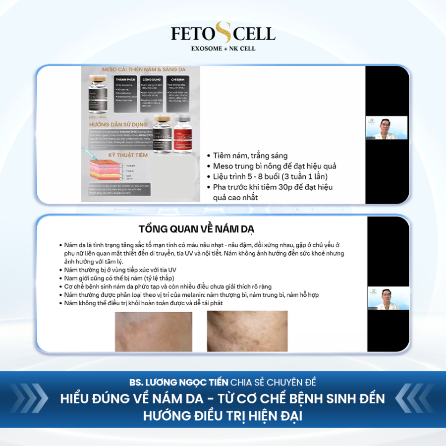 Bác sĩ Lương Ngọc Tiến chia sẻ chuyên đề "Hiểu đúng về nám da - Từ cơ chế bệnh sinh đến hướng điều trị hiện đại"