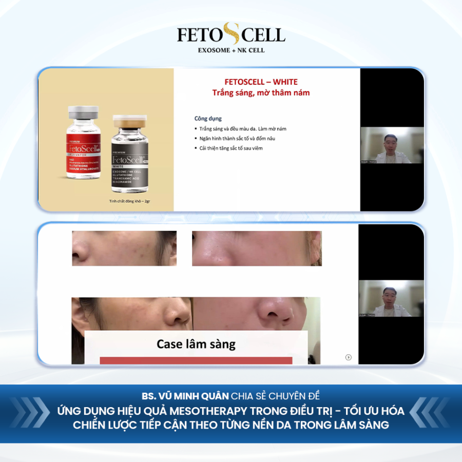 Bác sĩ Vũ Minh Quân chia sẻ chuyên đề "Ứng dụng hiệu quả Mesotherapy trong điều trị - Tối ưu hóa chiến lược tiếp cận theo từng nền da trong lâm sàng"