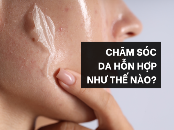 Chăm sóc da hỗn hợp như thế nào?