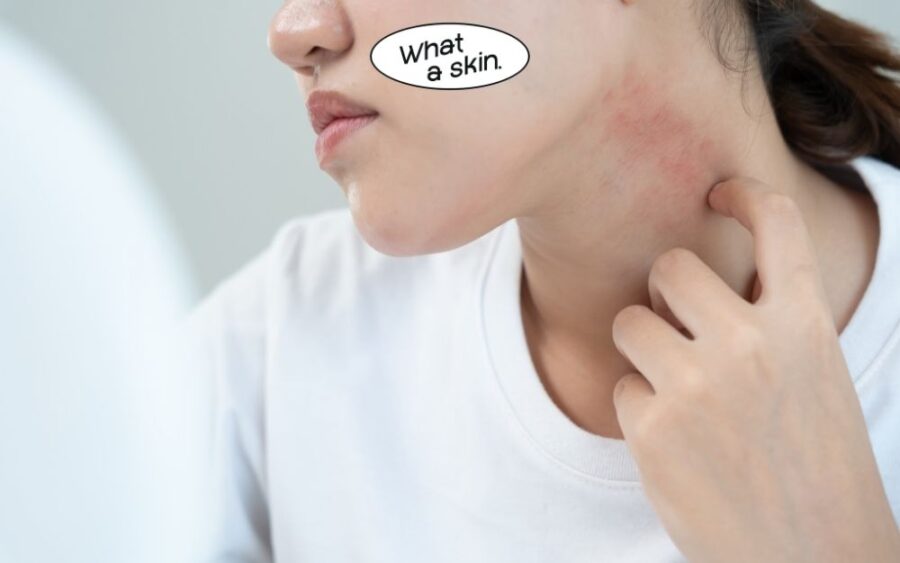 Da nhạy cảm có nên dùng Retinol