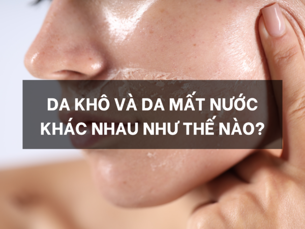 Da khô và da mất nước khác nhau như thế nào?